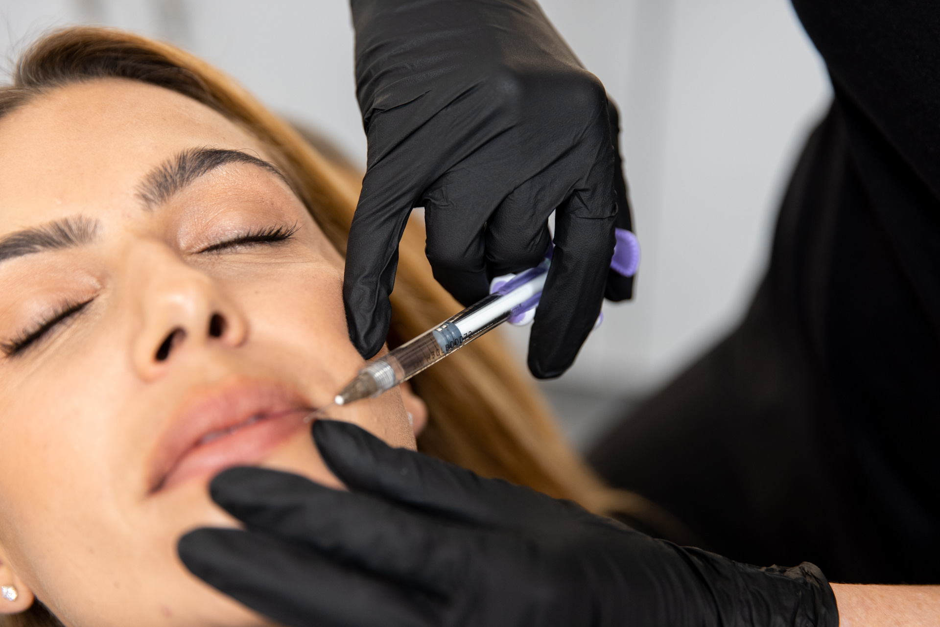 woman getting a wrinkle treatment in the Bay Area from Entre Nous Aesthetics