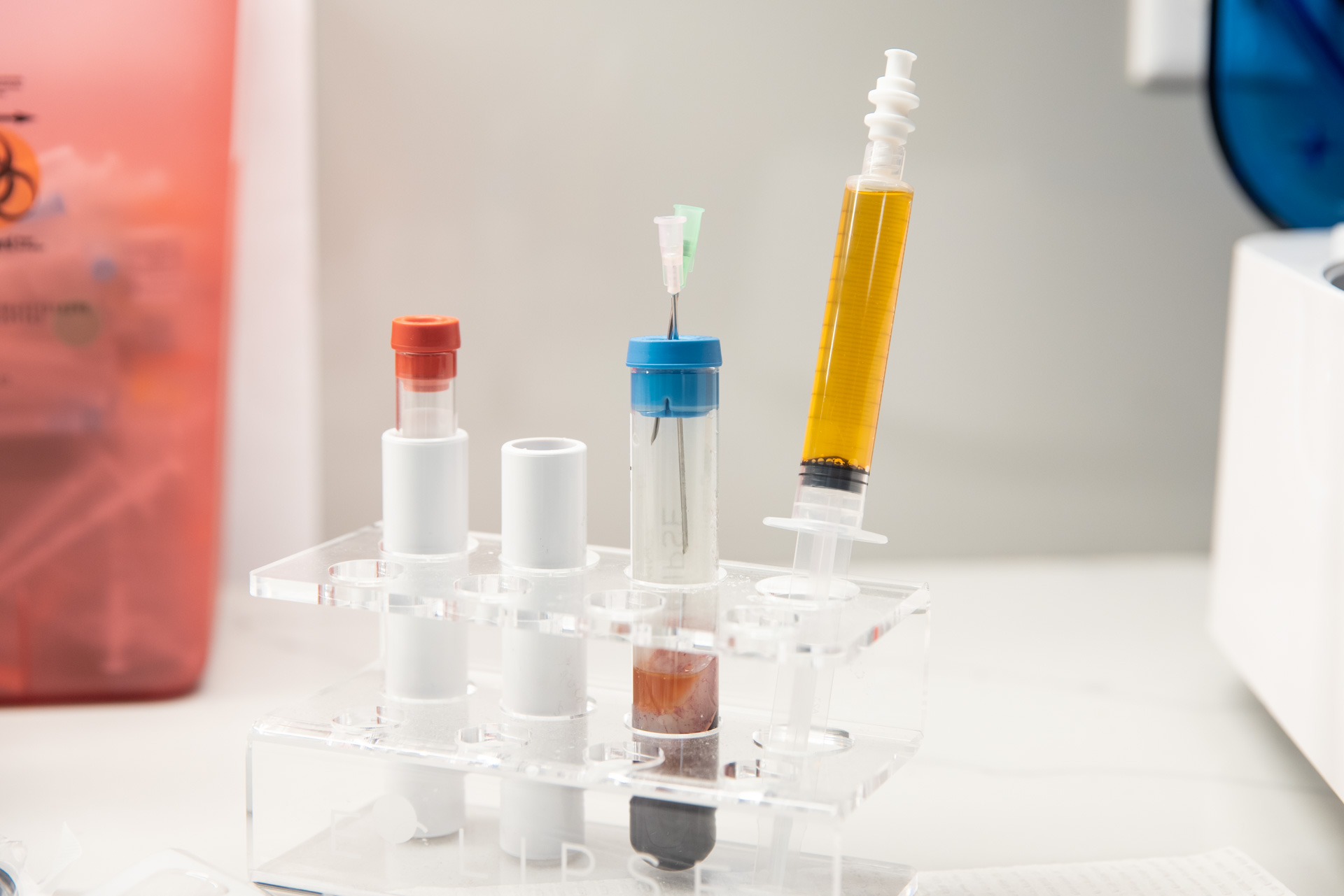 A syringe containing PRP for hair restoration rests on a stand