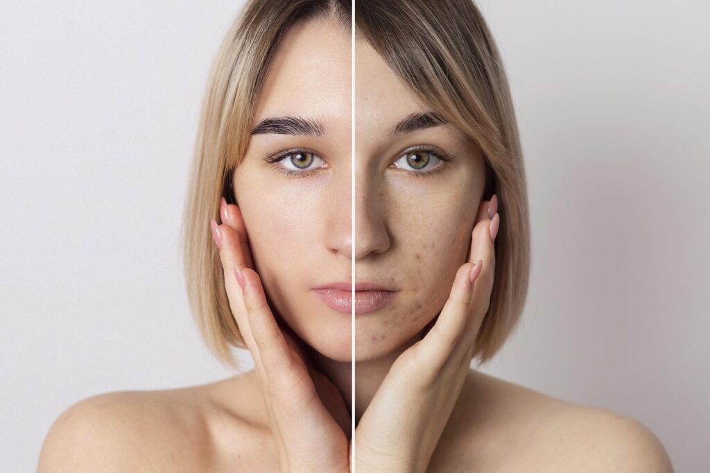 The before and after of s skin transformation